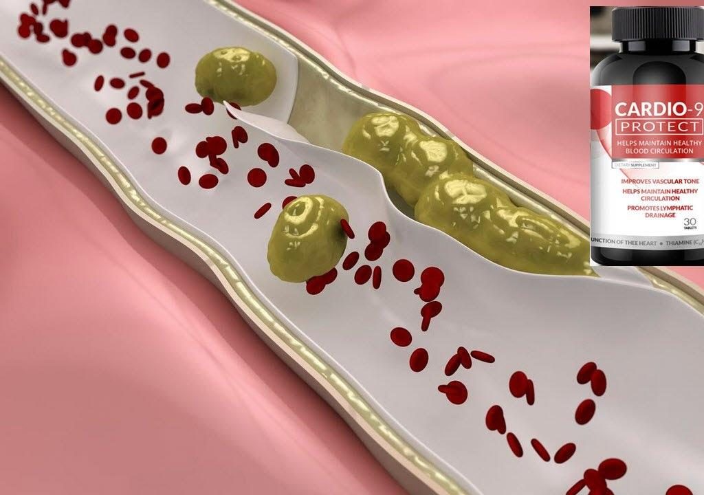 cardio 9 recensioni forum