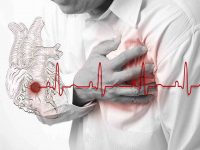 dolore cardiaco