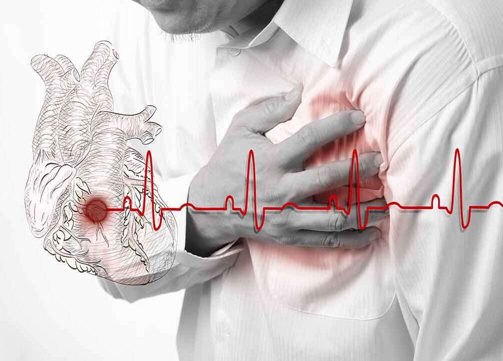dolore cardiaco