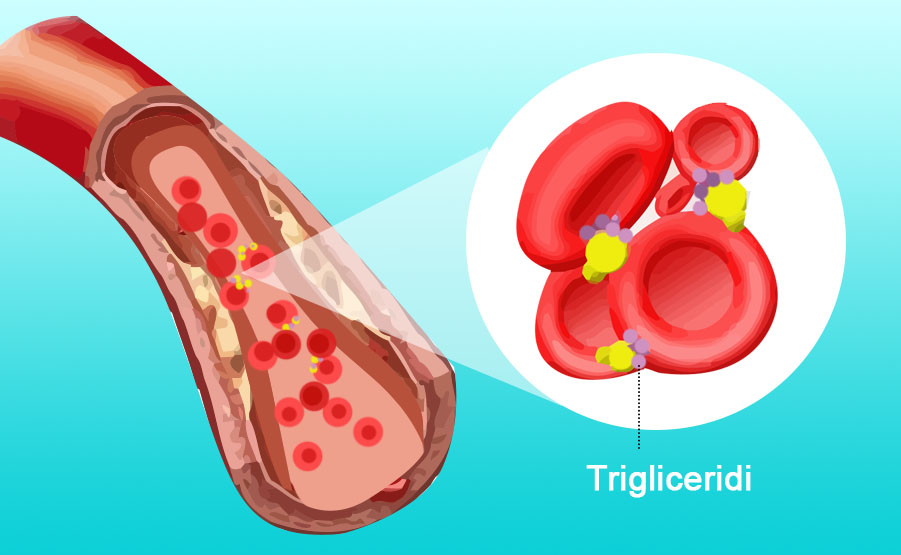 lipoproteina cause