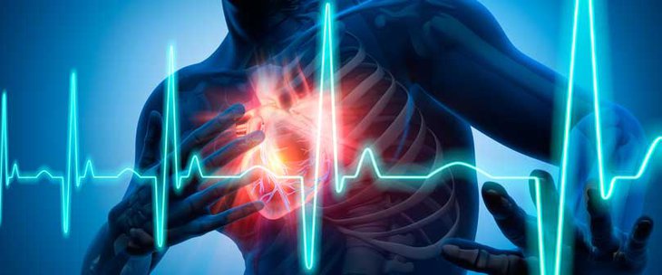 sintomi dolore cardiaco